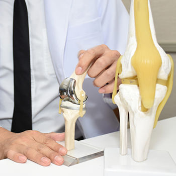Joint Replacement Surgery: What Patients Should Know — Shiva Hospitals Guntur