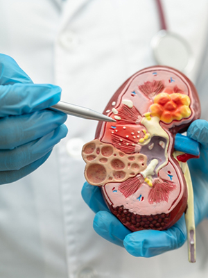 Nephrology department at Shiva Hospitals Guntur